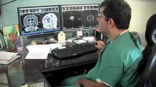 Matthew's Rare Brain Tumor