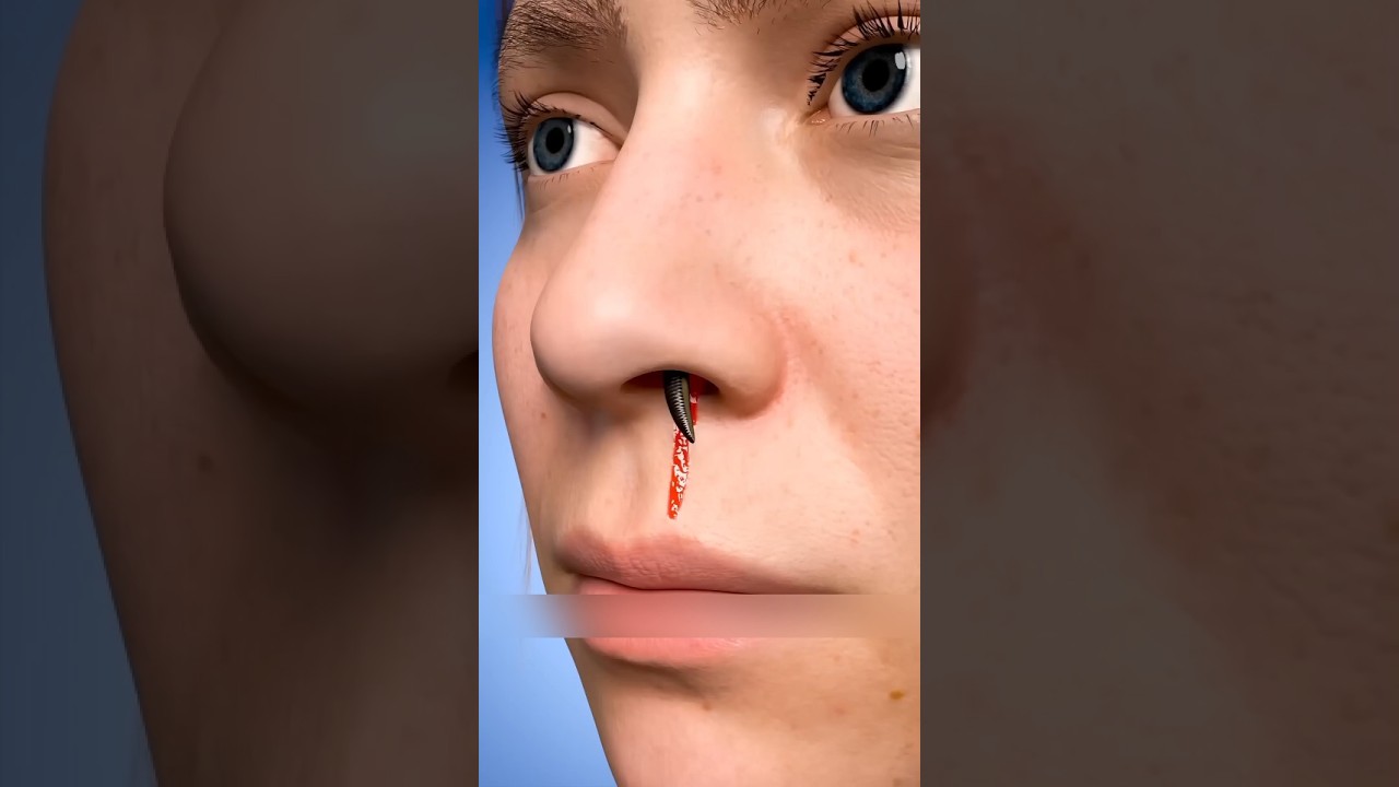 La sangsue cachée un bain devenu cauchemar 