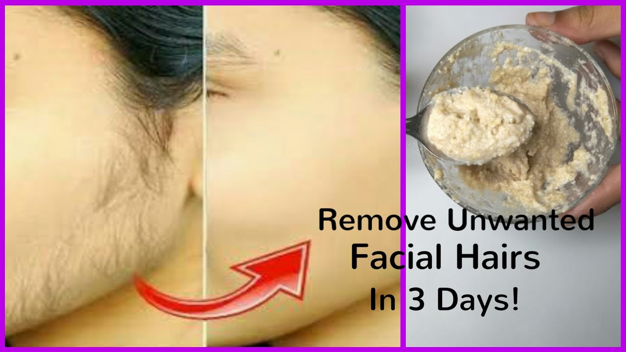 How To Remove Unwanted Hair Naturally At Home Without Pain In Just 3