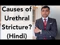 Causes of Urethral Stricture? | Hindi