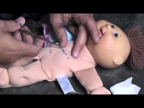 how to remove stitches