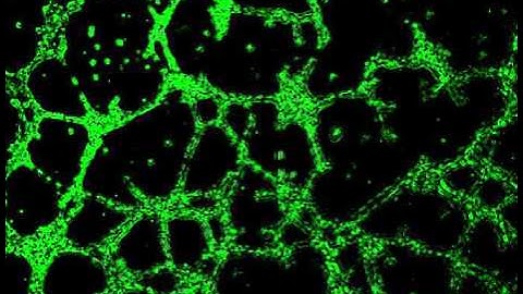 Tumor cell tube-forming assay
