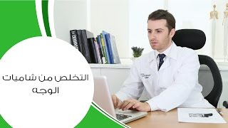 التخلص من شاميات الوجه I مع الدكتور كوستي