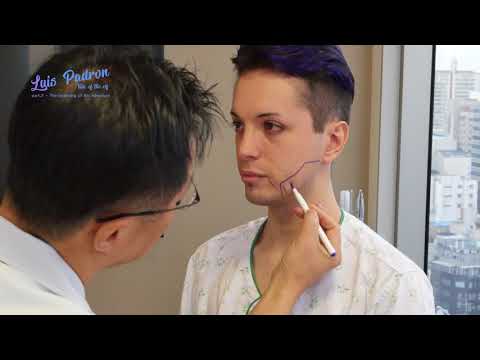 Luis Padron, the plastic surgery elf at ID Hospital Korea! Part 2