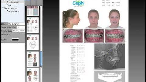 Quick Ceph Studio - Predefined Individual and Comparison Gallery Tempates