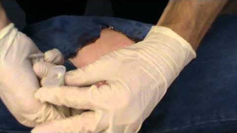 Intro to Celox Technology & Basic 