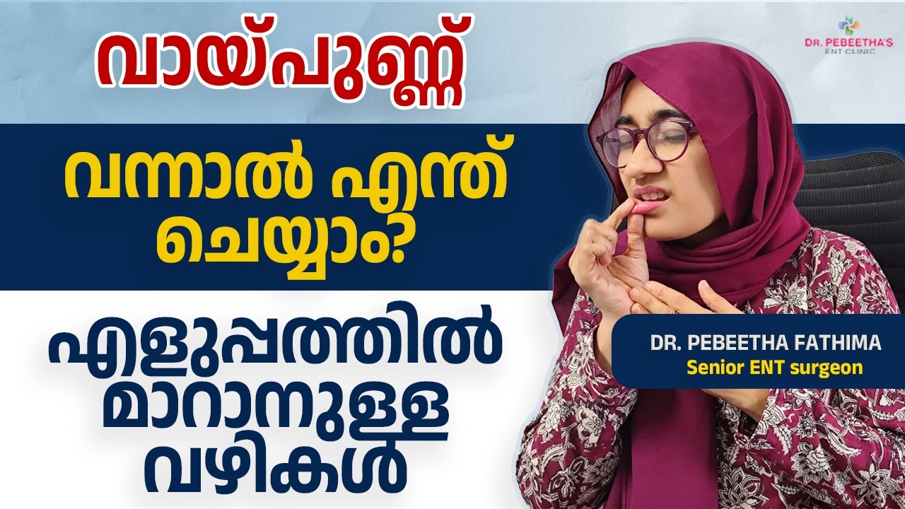 വായ്പുണ്ണ് 1 - 2 ദിവസം കൊണ്ട് മാറാനുള്ള മാർഗ്ഗങ്ങൾ. Fast fix for painful mouth ulcers.