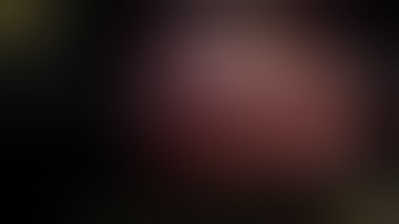 Fluorescence cholangiography: ICG spells safety