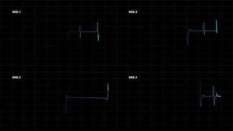 10 EKG Animation 4K | After Effects project | Videohive template