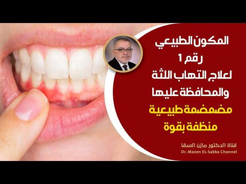 أفضل وصفة طبيعية لعلاج التهاب اللثة علاج التهابات اللثة وانتفاخها من اول يوم استعمال مضمضة طبيعية