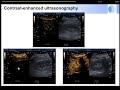 The microcirculation as a therapeutic target Jacques Duranteau 2015