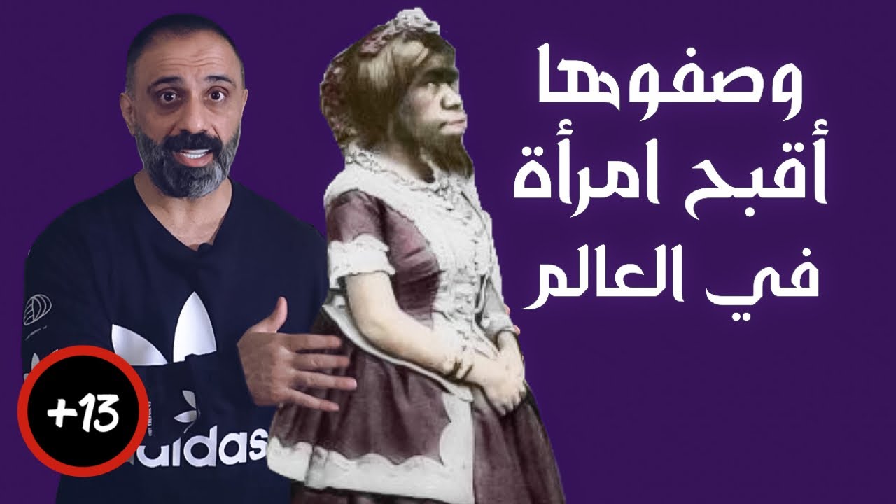 لقبت بأقبح امرأة في العالم ( جوليا بسترانا )