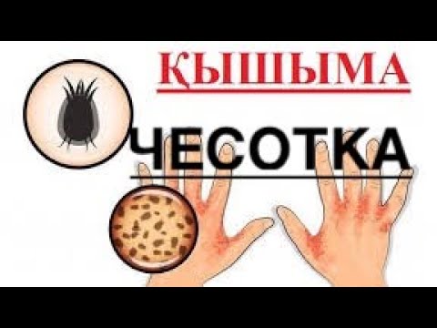 Бейне: Өрік қотырын қалай тоқтатуға болады: өріктегі шабдалы қотыры туралы біліңіз