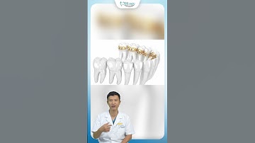 Niềng Răng Mắc Cài Mặt Lưỡi Trông Như Thế Nào ? | Bác Sĩ Yên