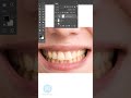 Teeth whitening just 10 Sec | Photoshop tips and tricks
