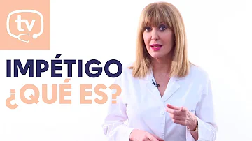 ¿Cómo se transmite el impétigo?