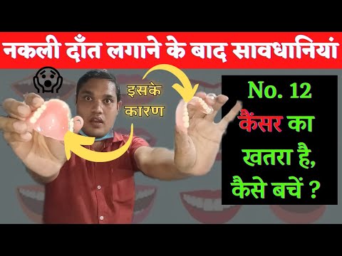 नकली दांत लगाने के बाद सावधानियां No.12 कैंसर का खतरा है 😱कैसे बचें ? #dentures #hindi #battisti