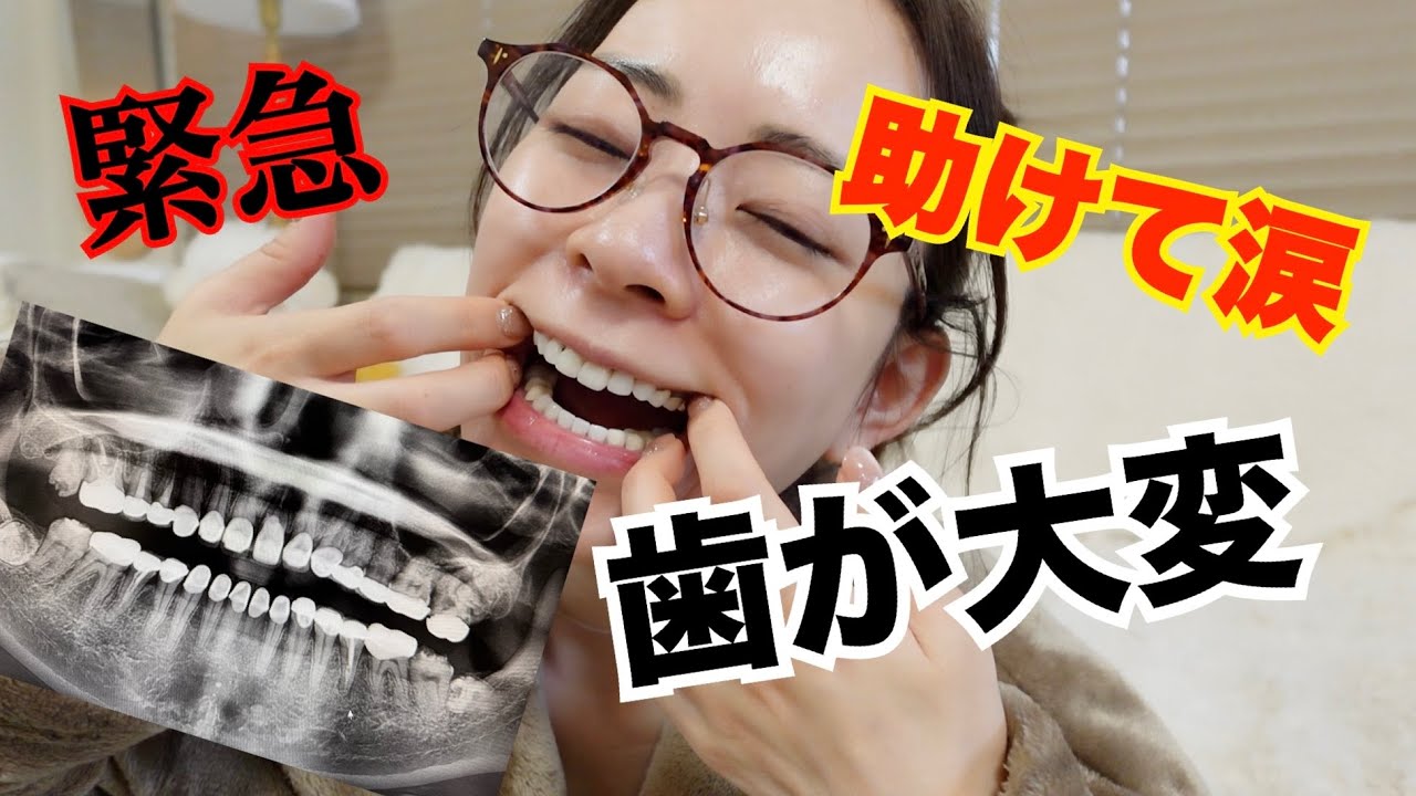 【緊急】また歯が大変なことになってるので助けてください...。