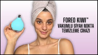 Foreo Kiwi Vakumlu Siyah Nokta Temizleme Cihazı 🧖🏻‍♀️🫧 Ürün İnceleme