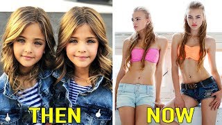 10 MOST BEAUTIFUL KIDS IN THE WORLD ALL GROWN UP