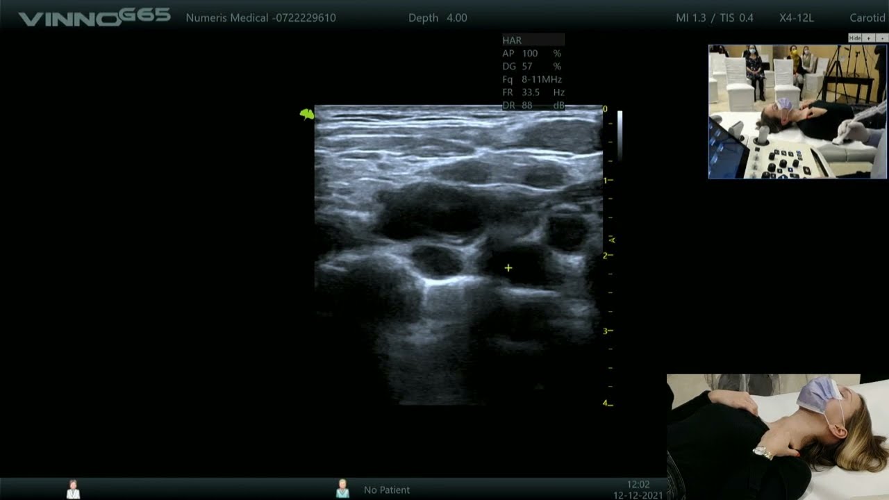 Examinare ecografică vase cervicale