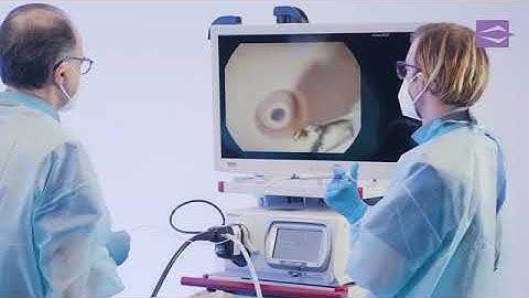 ERCP procedure  Stone Extraction using a Stone Extraction Basket