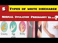 महीने के कौनसे दिन कैसा WHITE DISCHARGE होना चाहिए⁉️5️⃣TYPES OF WHITE DISCHARGE AND REASON 