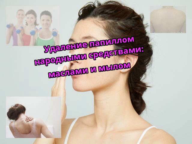 Удаление папиллом народными средствами: маслами и мылом