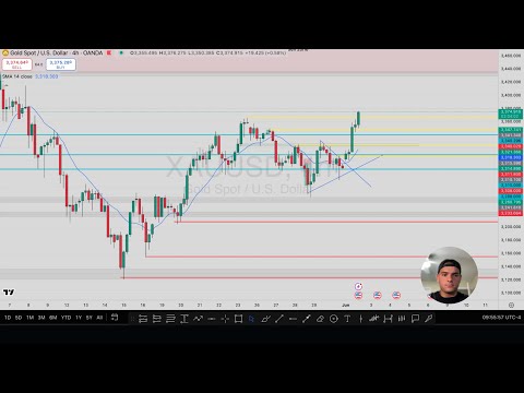 1:5 RR AUD/USD Trade Breakdown + Gold Market Blueprint (Must Watch!)
