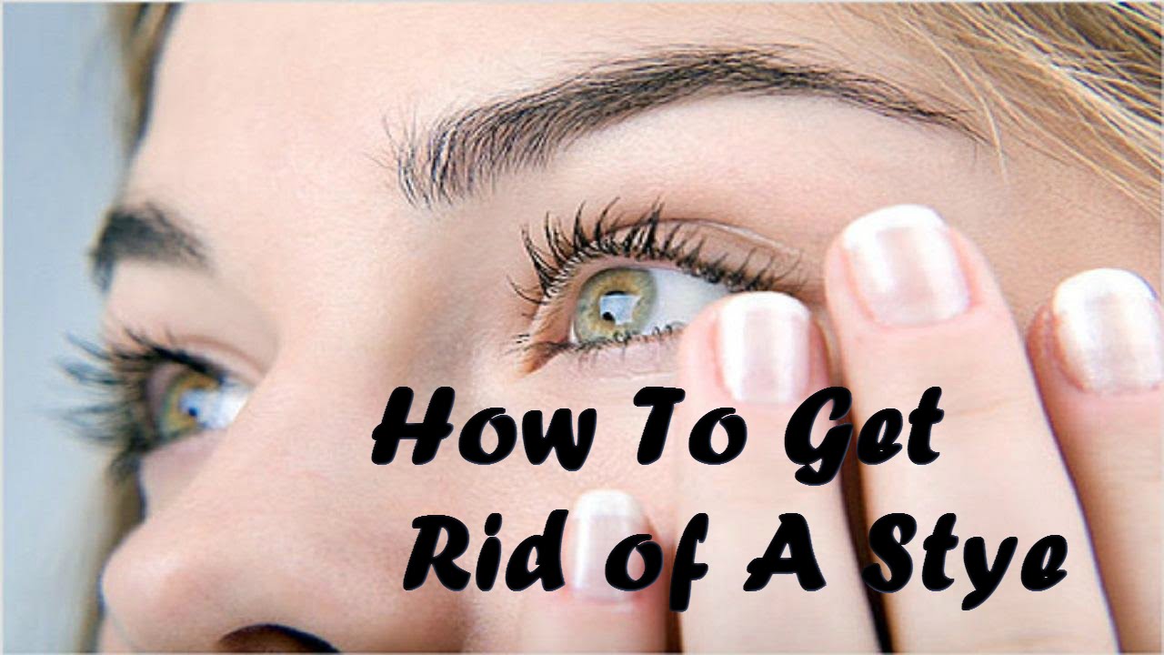 How to get rid of a stye youtube Stue skab