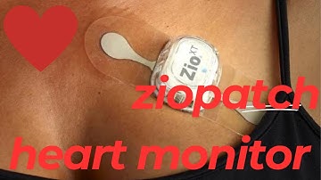 Zio Patch Heart Monitor