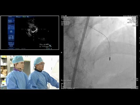 [COMPLEX PCI 2018] Live Case Demonstration 2