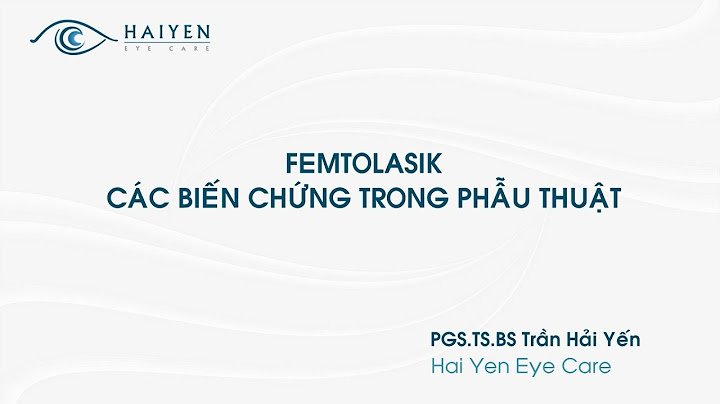 Phương pháp mổ mắt femto lasik