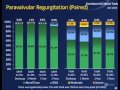 Dr david muller transcatheter aortic valve implantation in 2015