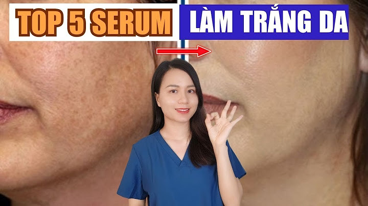 Top 5 kem dưỡng trắng da tốt nhất