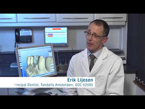 A Dental Crown in 1 Visit by Welling Corner Dental Practice