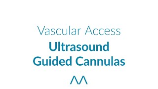 Ultrasound Guided Cannulas