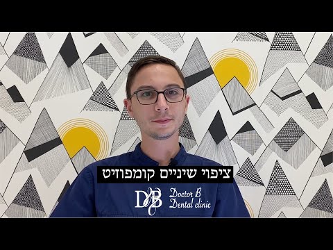 וִידֵאוֹ: כמה זמן מחזיק חיפוי קומפוזיט?