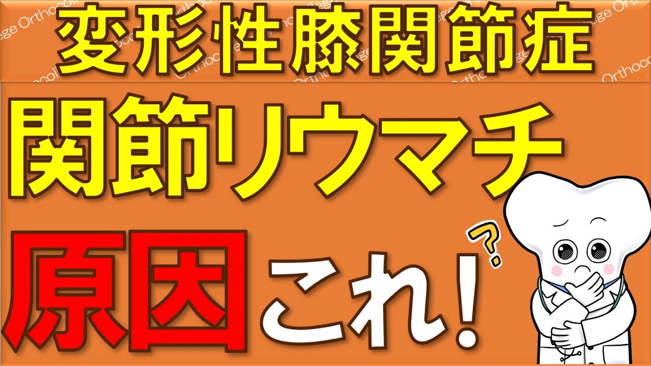 関節リウマチの全て!初期症状から治療法まで徹底解説 【医師が解説】