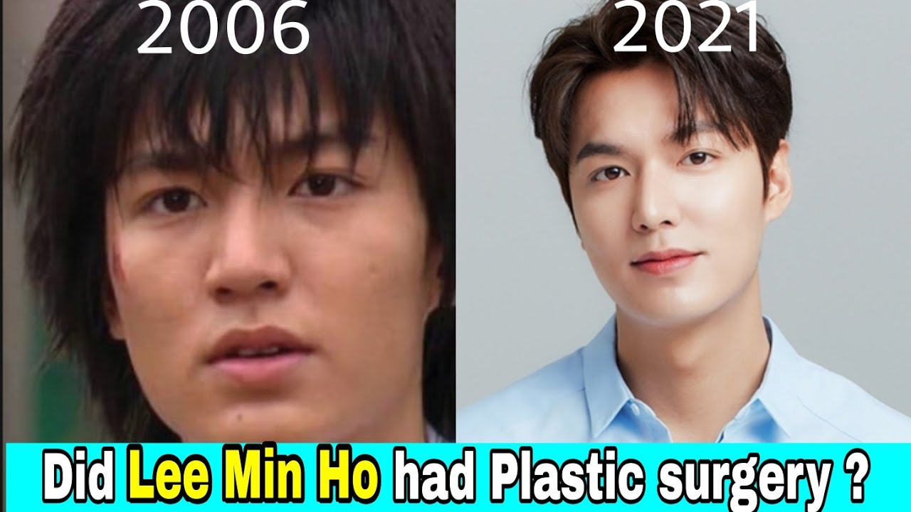 Lee Min Ho ever had Plastic surgery ? - YouTube
