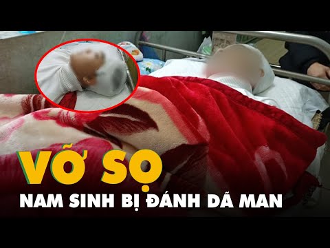 Video Nam sinh bị bạn cùng trường đánh vỡ sọ não ở Thanh Hóa - YouTube