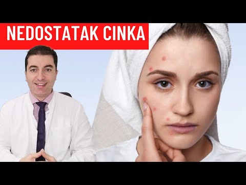 Video: Cink Za Alergije