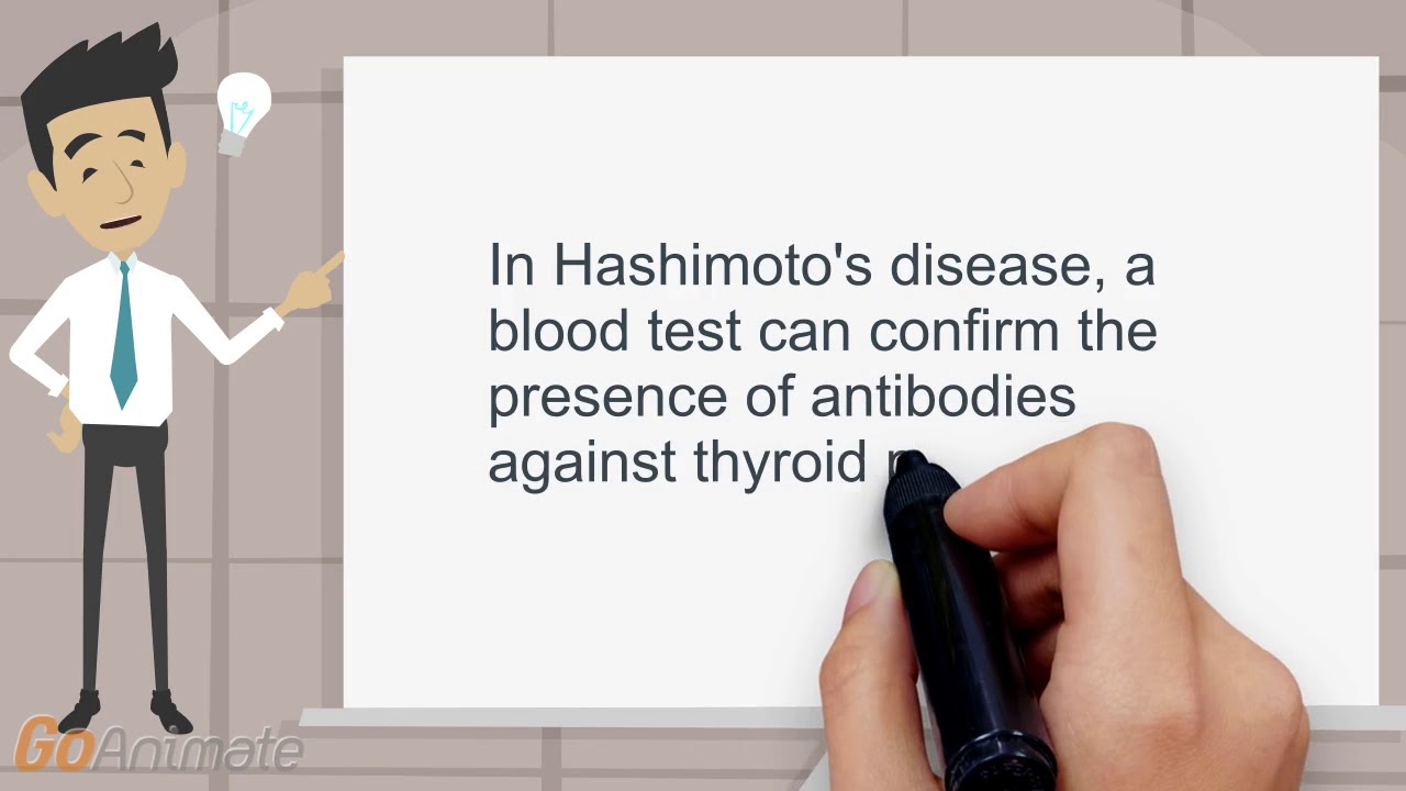 TPO antibodies in hypothyroidism YouTube