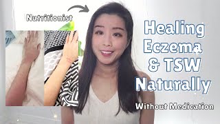 How I am Healing Eczema and TSW Naturally as a Nutritionist | Anti-inflammatory Diet