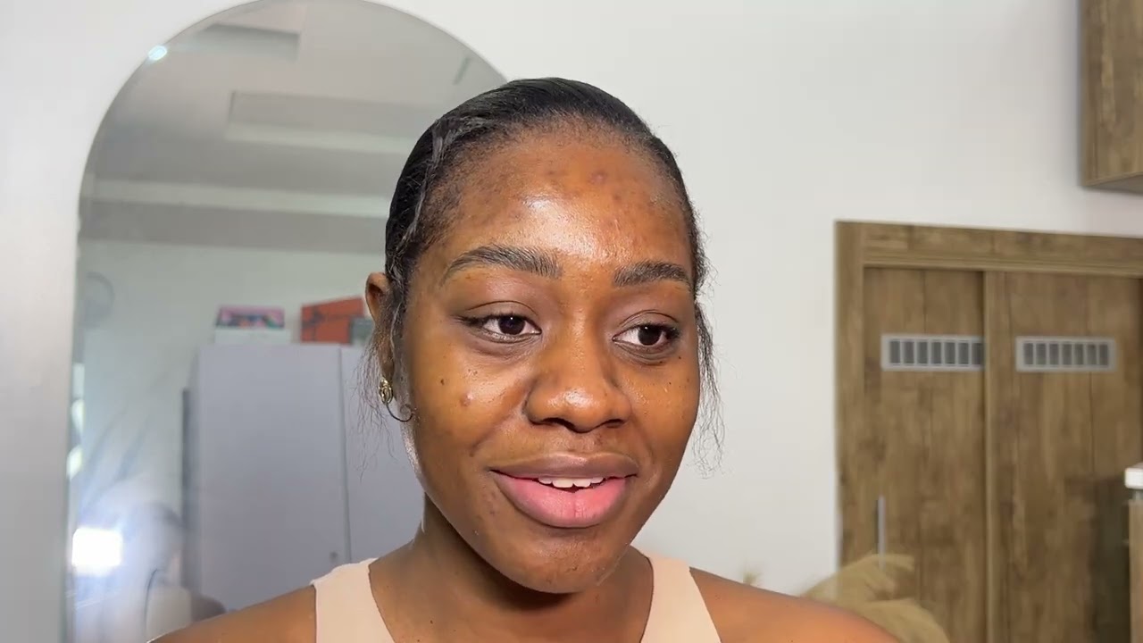 HOW TO LOOK GOOD WITHOUT MAKEUP || ”HYPERPIGMENTATION SKIN”