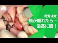 歯周病で歯ぐきに膿が溜まる?!歯肉腫瘍の切開治療 Become Pus-Filled In Gums With Periodontal Disease!?