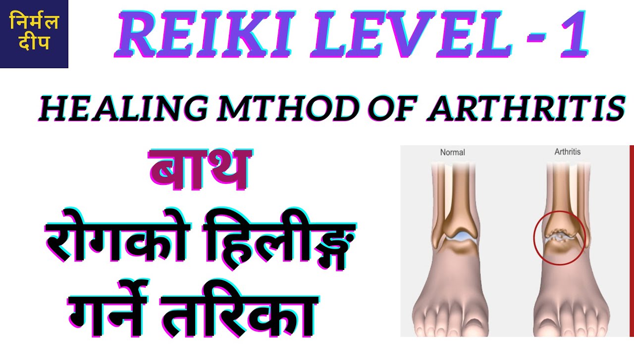 REIKI HEALING OF ARTHRITIS बाथको हिलीङ्ग गर्ने तरिका नेपालीमा