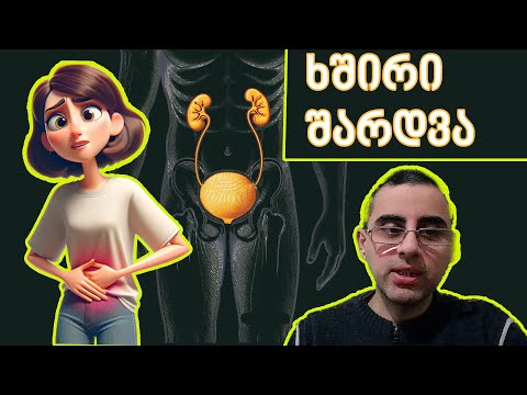 ხშირი შარდვა, ტოპ 5 მიზეზი და მკურნალობა