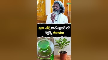 best medicine for gall bladder stones | PMC Health