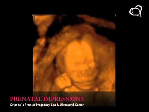 ultrasounds orlando